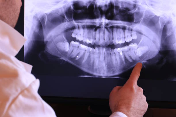 Best Dentist for Tooth Abscess  in Punta Rassa, FL