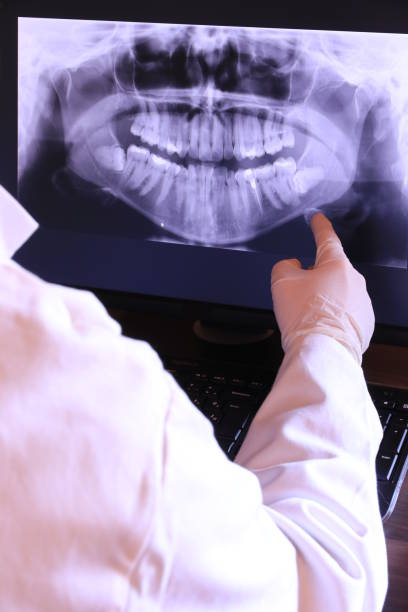 Best Tooth Infection Emergency Dentist  in Punta Rassa, FL