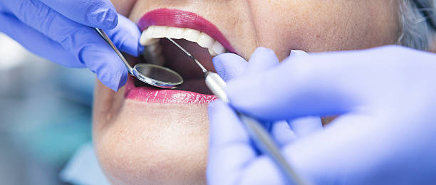 Best Dentist for Tooth Abscess  in Punta Rassa, FL